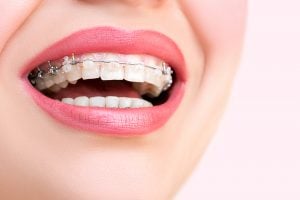 بهترین دندانپزشک در اصفهان ، ایمپلنت دندان در اصفهان ، کامپوزیت دندان در اصفهان ، لمینت دندان در اصفهان