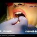 قالب گیری ایمپلنت دندان در اصفهان